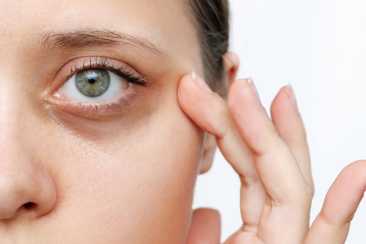 অনিয়মিত ঘুম ও খাবারের কারণে চোখের নিচে ডার্ক সার্কেল হয়। ত্বকের টানটান ভাব কমে, বয়স বেশি দেখায়।
